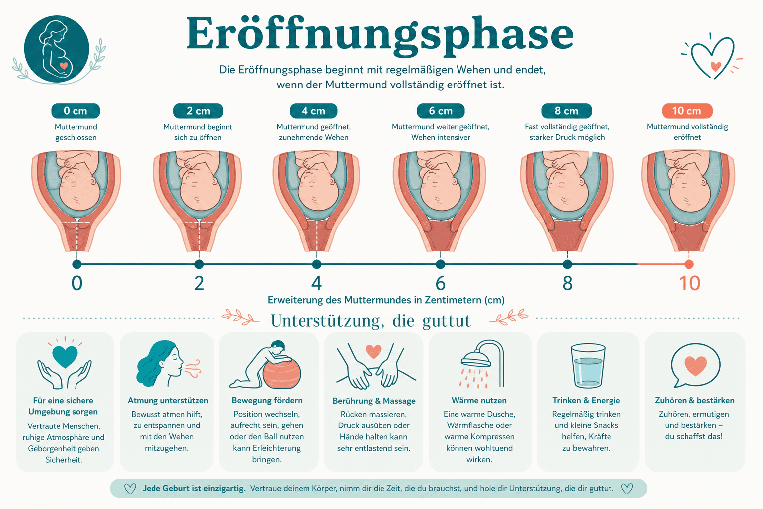 Schema Wehenzählung: Dauer einer Wehe, Abstand zwischen Wehen und Stärkeeskala für die Eröffnungsphase