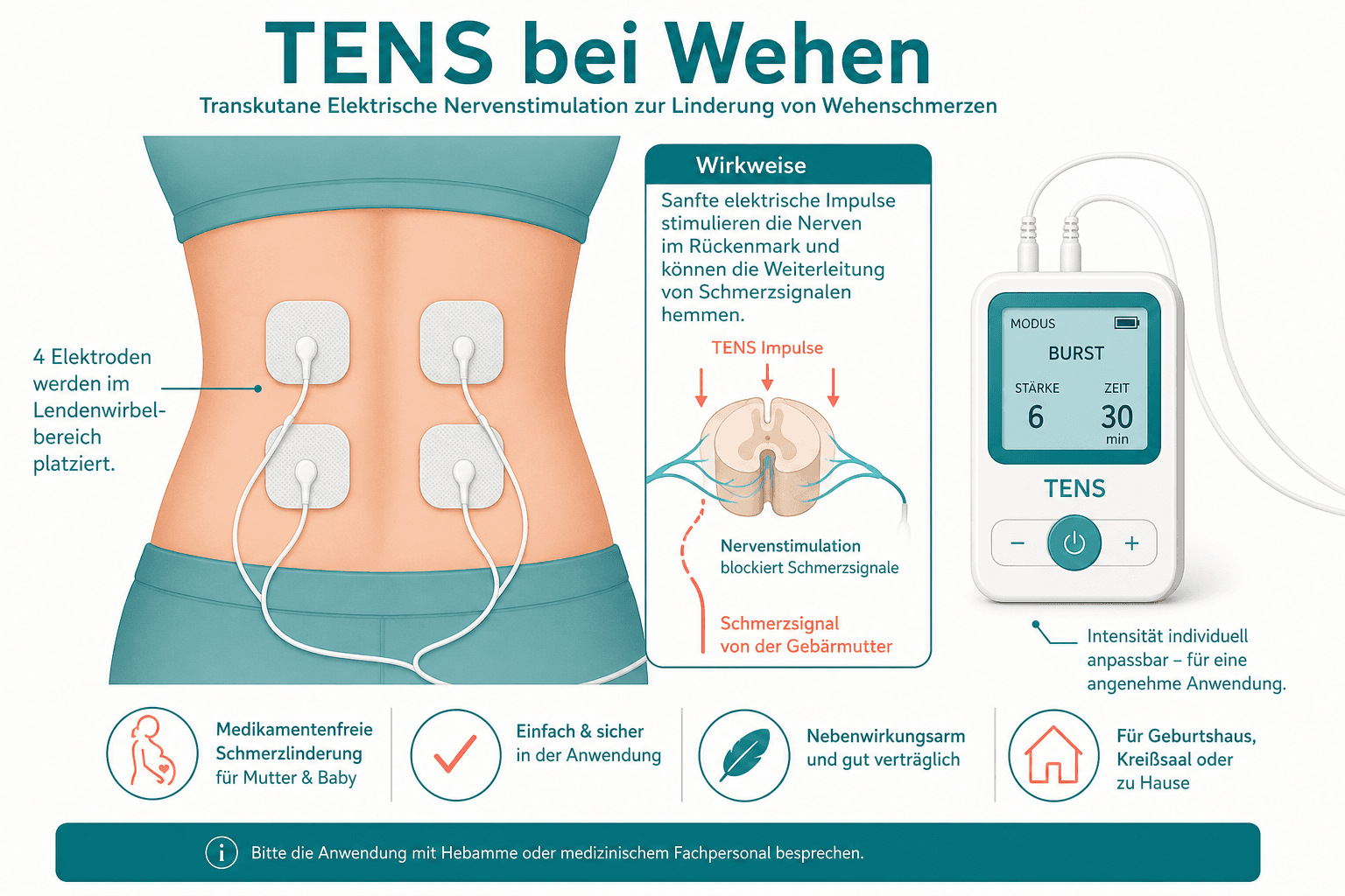 TENS-Gerät mit vier Elektroden auf dem unteren Rücken einer Gebärenden